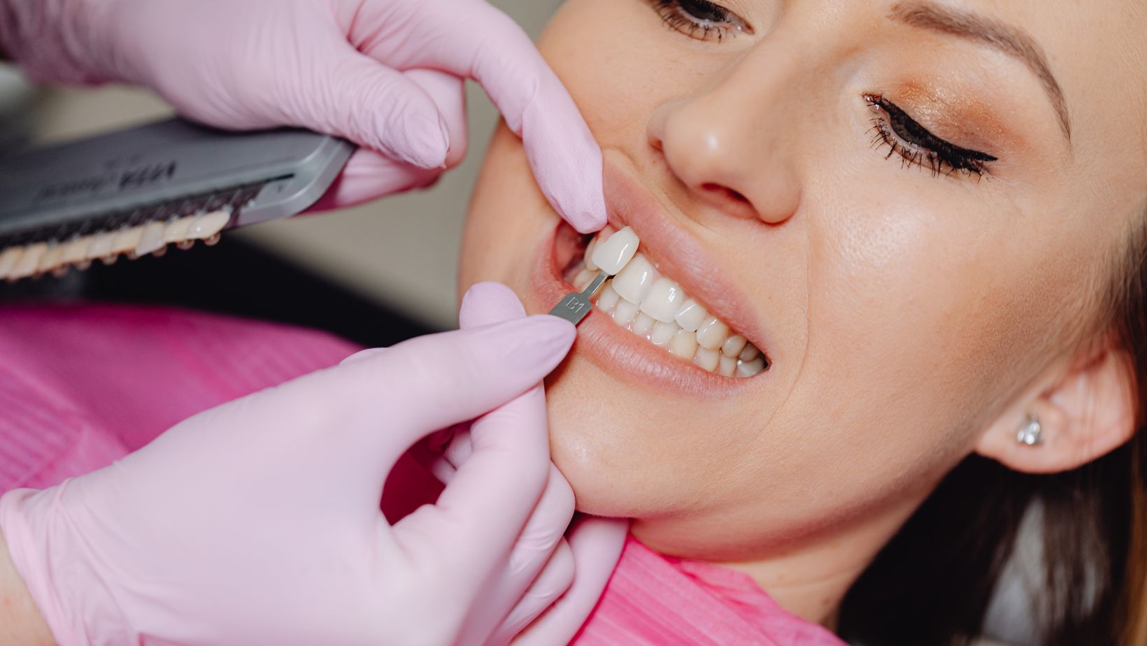 how to get veneers covered by insurance
